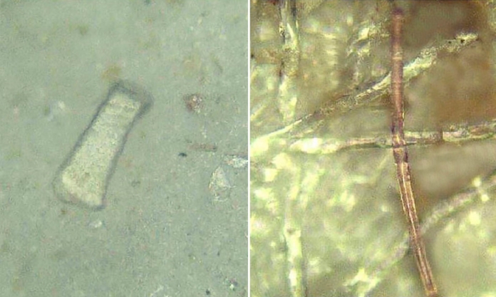 The Nanjinger - Bowel Disease Link to Microplastics Found by Nanjing Medical Uni The Nanjinger - Bowel Disease Link to Microplastics Found by Nanjing Medical Uni