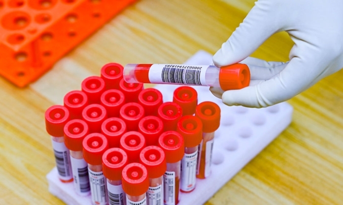 The Nanjinger - Is there an End to all these Nucleic Acid tests? For some, Maybe The Nanjinger - Is there an End to all these Nucleic Acid tests? For some, Maybe