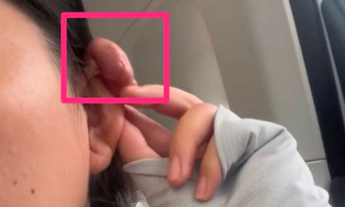 The Nanjinger - Radiotherapy after Ear Piercing? Back to Hygiene School for Some