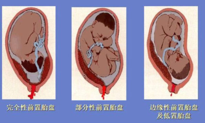 The Nanjinger - Woman in Changzhou Unaware She was Pregnant for 8 Months