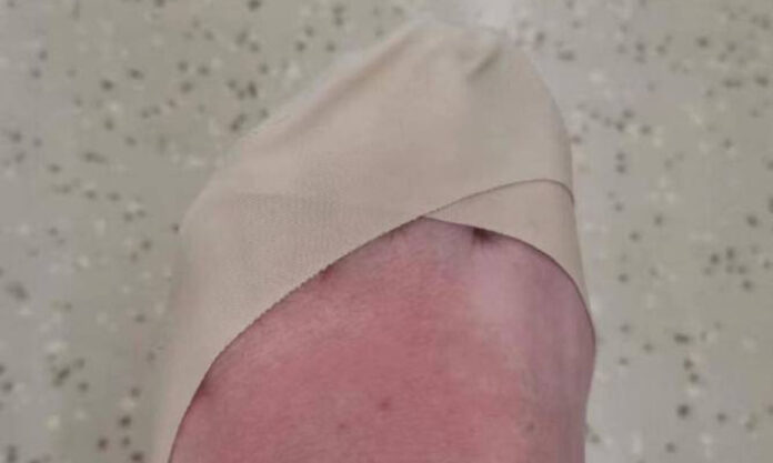 The Nanjinger - Venomous Snake Bites Woman in Taizhou; Instant & Unbearable Pain