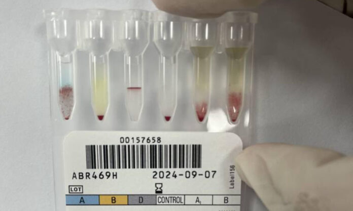 The Nanjinger - 1st Ever Case of Staggeringly Rare Blood Type Found in Zhenjiang